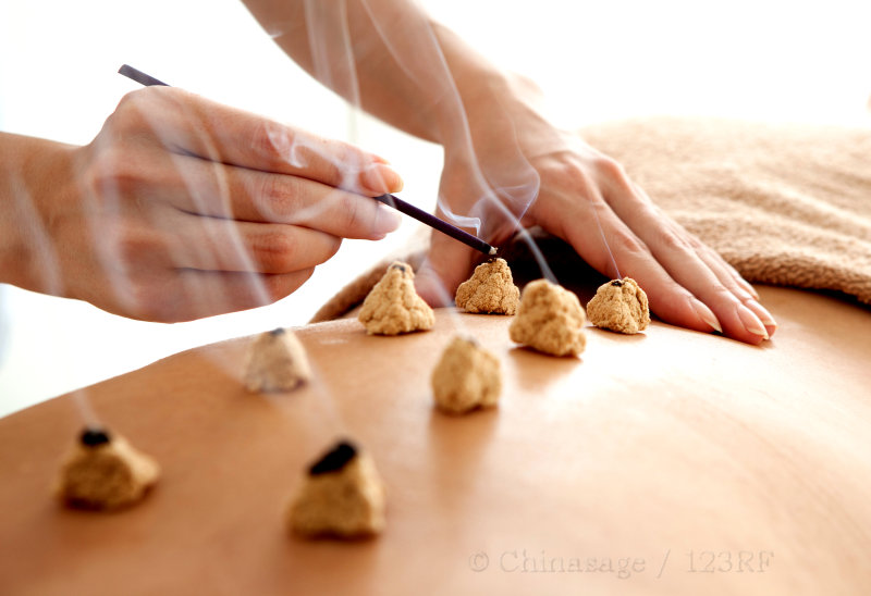 Moxibustion, TCM, moxibustion